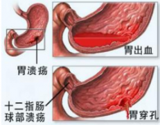 看胃病医院厦门哪个好