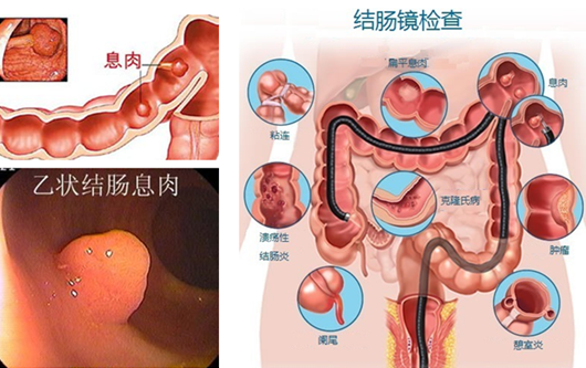 厦门糜烂性胃炎治疗较好的医院是哪家